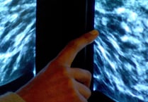 Breast screening uptake in Gloucestershire remains below pre-pandemic levels