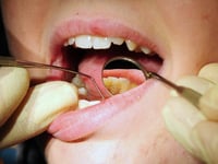 Two in five people in Gloucestershire struggle to get an NHS dentist appointment