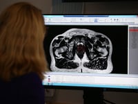 More men diagnosed with prostate cancer in Gloucestershire