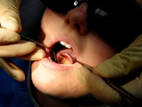 A fifth of children have rotting teeth in the Forest of Dean