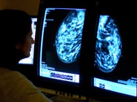 More women in Gloucestershire undergo breast cancer screening – as NHS England target met for first in five years