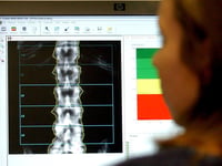 One in six people in Gloucestershire suffer joint, bone and muscle conditions