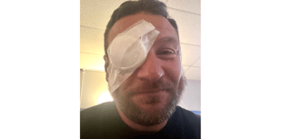 Golfer blinded in one eye by wayward shot