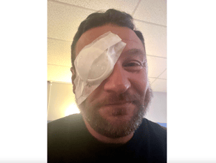 Golfer blinded in one eye by wayward shot