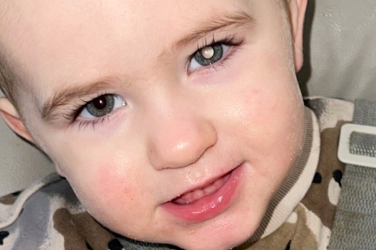 Koopers left eye with the glow. A toddler was diagnosed with eye cancer after his parents noticed a white glow in his left eye. Shane Stevenson, 35, and his partner, Lowri Gallagher, 30, were at home when they noticed a white glow in their then one-year-old son, Kooper's eye. It was only noticeable in low-light conditions or when they took a photo of Kooper with the flash on. An ultrasound revealed a lump in Kooper's eye, and he was referred to Birmingham Women and Childrens Hospital in December 2024. He underwent an optical coherence tomography scan - an advanced scan that allows opticians to assess your eye health - before he was diagnosed with retinoblastoma - a rare eye cancer that typically affects children under the age of six. In December 2024, Kooper started intra-arterial chemotherapy - a targeted cancer treatment where chemotherapy drugs are delivered directly to the area - before having laser therapy and one round of chemotherapy injections. The tot is still undergoing treatment, and Shane said the results have been "mixed".